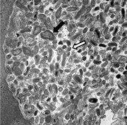 Transmission electron micrograph showing a PV harboring Coxiella developmental forms.