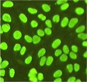 Nuclear staining with FcγRII -/- Nucleolar staining in FcγRII -/- Yaa no staining in WT