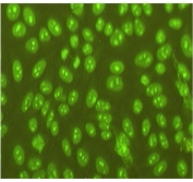 Nuclear staining with FcγRII -/- Nucleolar staining in FcγRII -/- Yaa no staining in WT