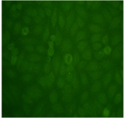 Nuclear staining with FcγRII -/- Nucleolar staining in FcγRII -/- Yaa no staining in WT