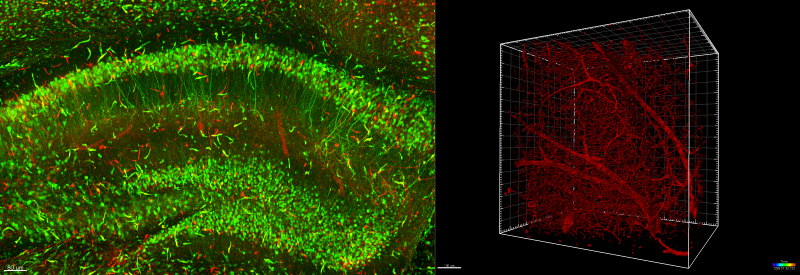 CAT-I 3D visualizations of neuronal processes, blood vessels, and vascular networks
