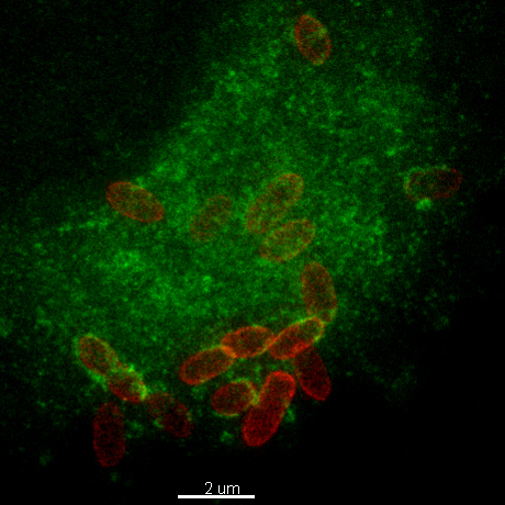 Stimulated emission depletion (STED) microscopy was used to explore intracellular trafficking of in Granulibacter bethesdensis (Cy5-labeled, red) as it localized to vacuoles containing Lysosomal-Associated Membrane Proten-1 (LAMP-1, green) in human monocy