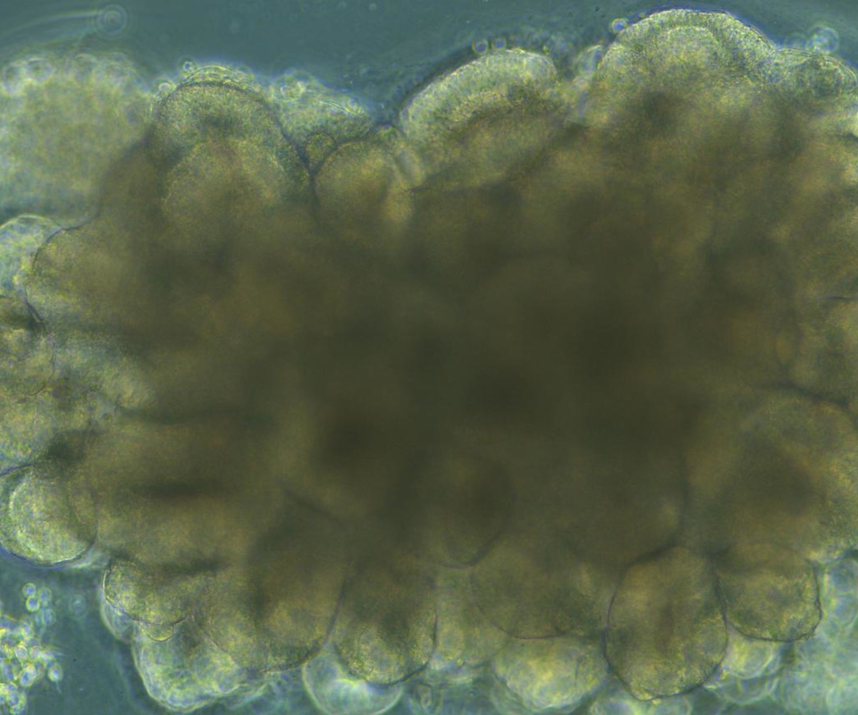 Cerebral organoid