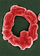 Pseudocolored scanning electron micrograph of the first characterized mutant of Coxiella generated by genetic transformation: a filamentous Himar1 ftsZ mutant arranged in a “Q” shape. 