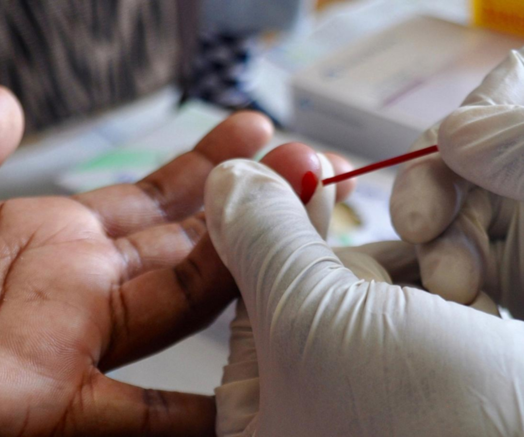 HIV test