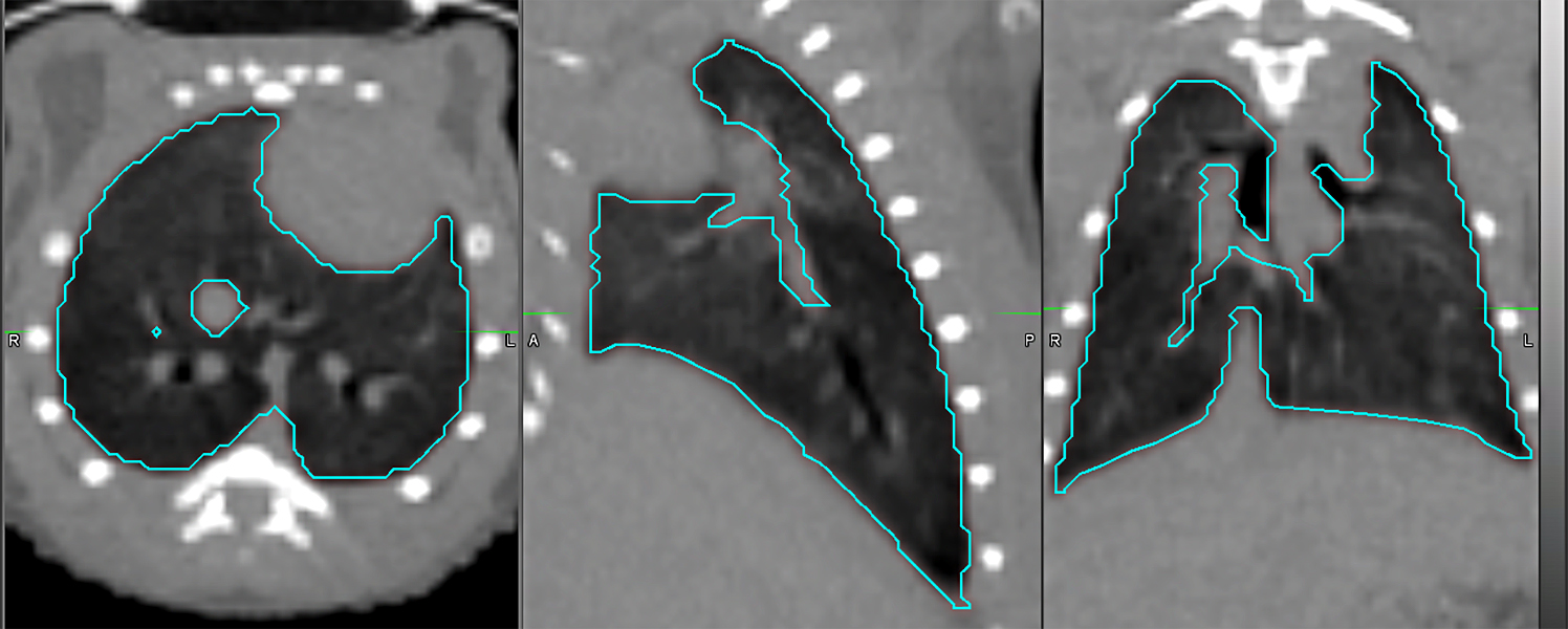 Image of lung segments.