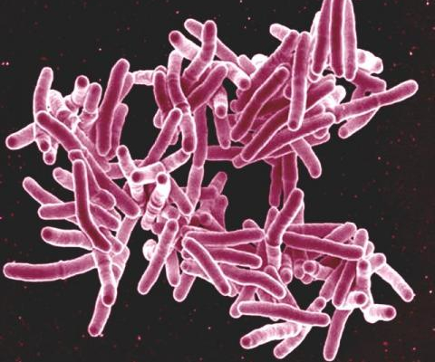Scanning electron micrograph of <em> Mycobacterium tuberculosis </em> bacteria, which cause TB.