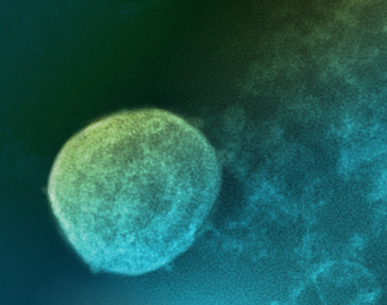 A Nipah virus particle budding from a cell used to grow viruses.