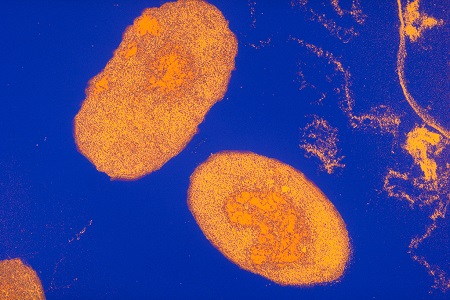Pertussis (Whooping Cough)  NIH National Institute of Allergy and
