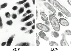 Purified SCV and LCV with characteristic condensed and dispersed chromatin, respectively. 