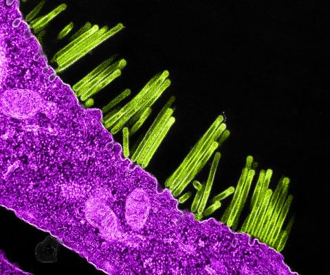Swine flu virus particles