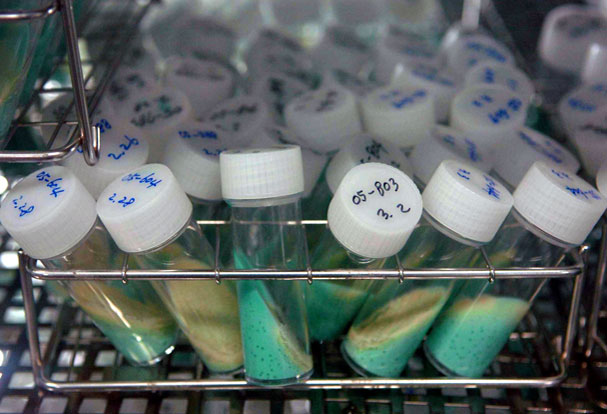 Sputum cultures from tuberculosis patients. Sputum often is used to detect and identify bacteria in the lungs.