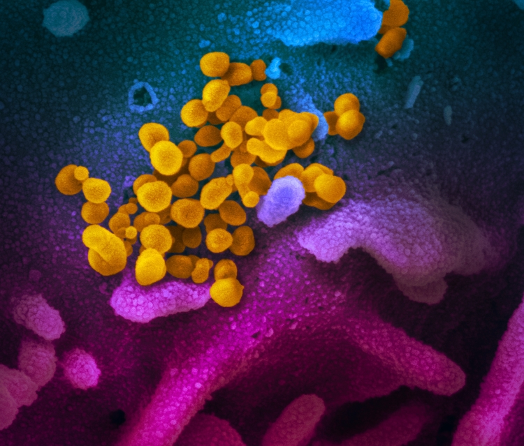 National Institute Of Allergy And Infectious Diseases Niaid
