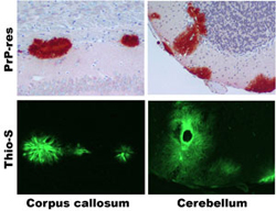 Protease-resistant prion protein (PrP-res)