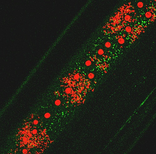 Wolbachia induce Autophagy in Brugia malayi. Green: autophagosomal protein; small red dots: Wolbachia; red spots: worms nuclei.