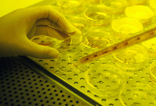Scientist prepares a tissue culture.