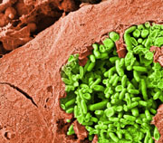 Pseudocolored scanning electron micrograph of a cryo-prepared Vero cell (orange) containing a PV filled with Coxiella (green). 