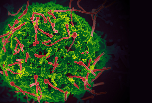 Ebola virus (red) budding from the surface of an infected cell