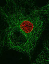 Chlamydial inclusion showing association with mirotubules.