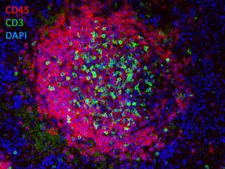 Double-Label Immunofluorescence of a Lymphoid Follicle Left