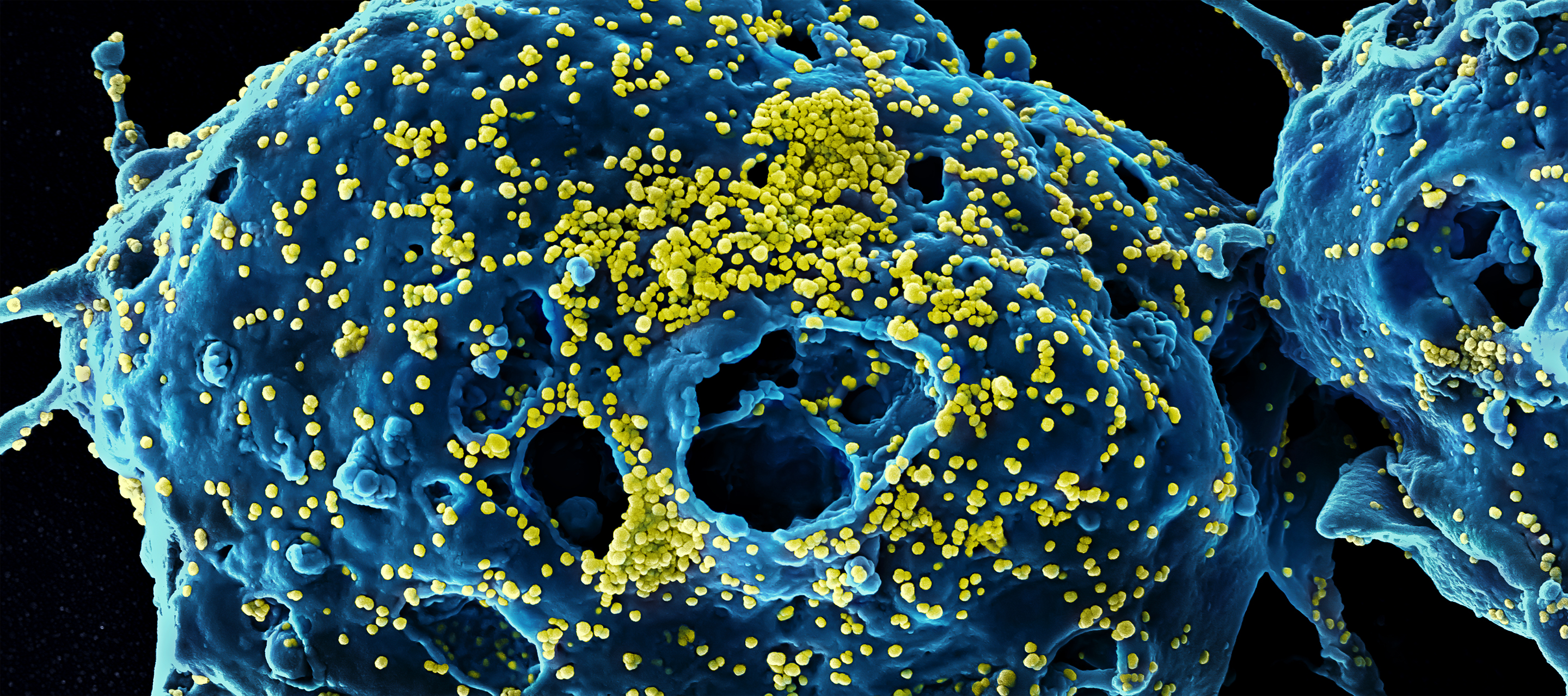 COVID-19 Clinical Research | NIH: National Institute of Allergy and Infectious Diseases