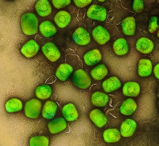 Colorized transmission electron micrograph of monkeypox virus particles