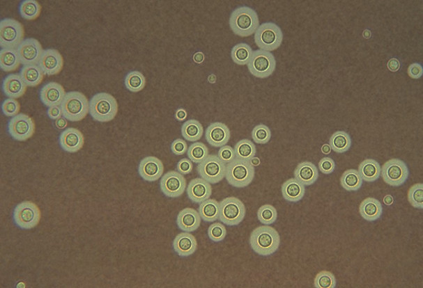 Cryptococcus neoformans.