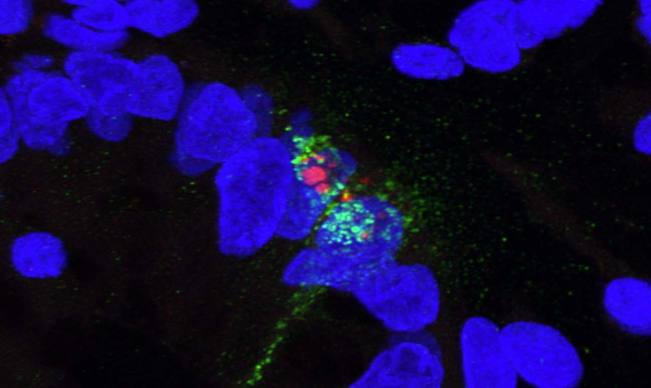 Norovirus-infected enteroendocrine cell (EEC)