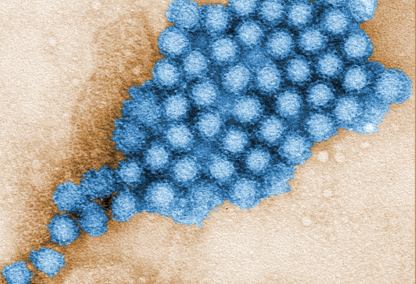 Transmission electron micrograph of norovirus particles.