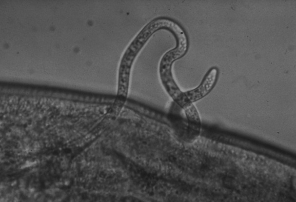 An O. volvulus parasite emerges from an infected blackfly.