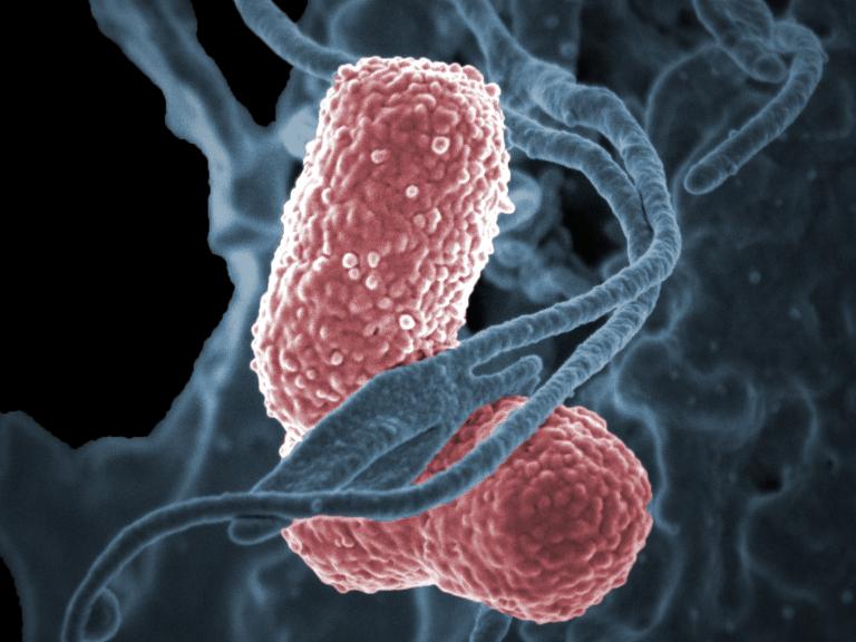 Klebsiella pneumoniae (pink), a multidrug–resistant bacterium