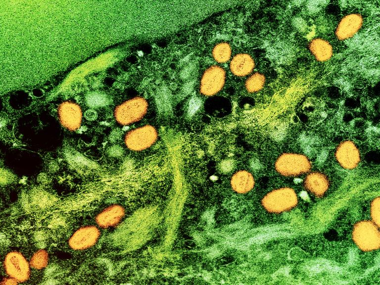 mpox particles in an infected cell.