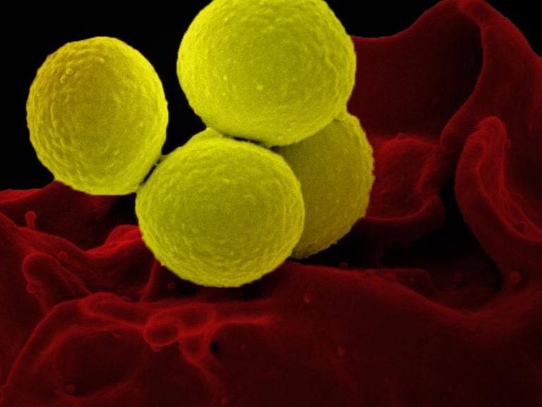 Scanning electron micrograph of a human neutrophil ingesting MRSA (yellow).