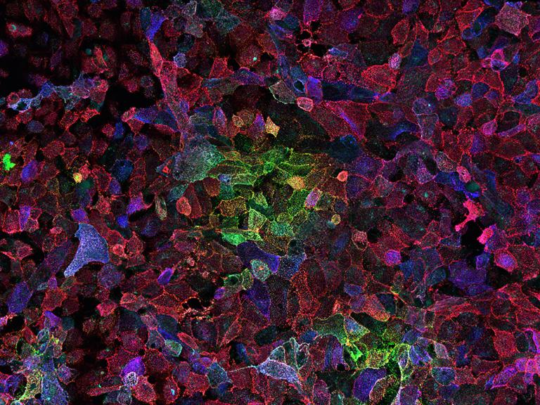 purple and green patterns of cells with green and yellow highlighted areas