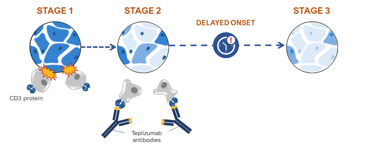 Illustration of pancreatic cells in three stages showing how Teplizumab binds to CD3 on T cells and reduces their ability to destroy Beta cells.