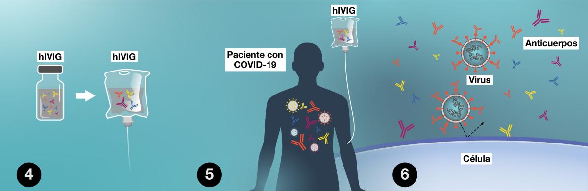 Una infografía que muestra cómo funciona la producción y administración de hIVIG. El texto a continuación brinda detalles completos de los pasos.