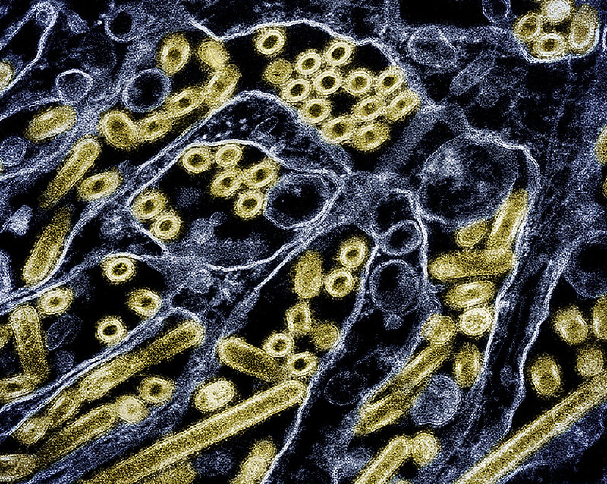 Image of Colorized transmission electron micrograph of avian influenza A H5N1 virus particles.