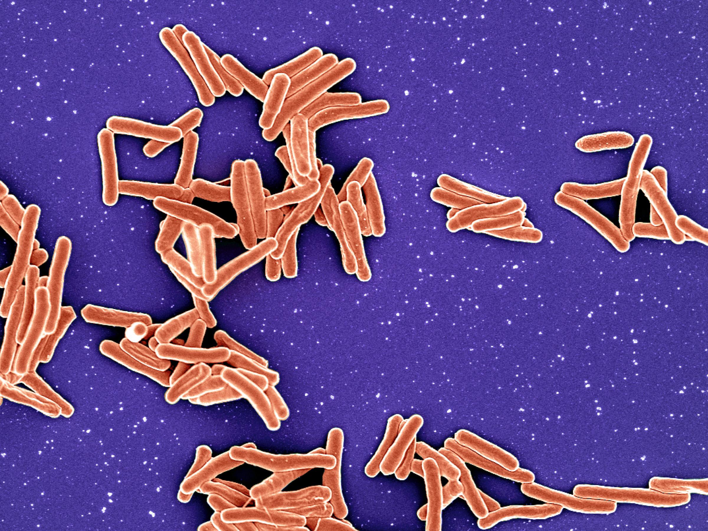 A cluster of overlapping orange rod shapes on a purple background.