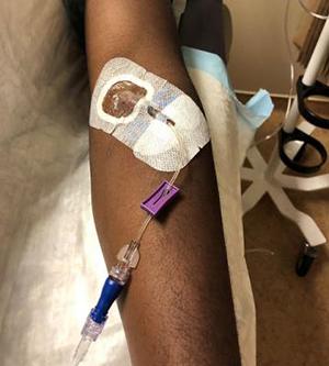 infusion going into patient's arm