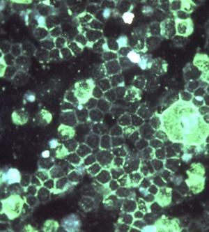green particles on a black background