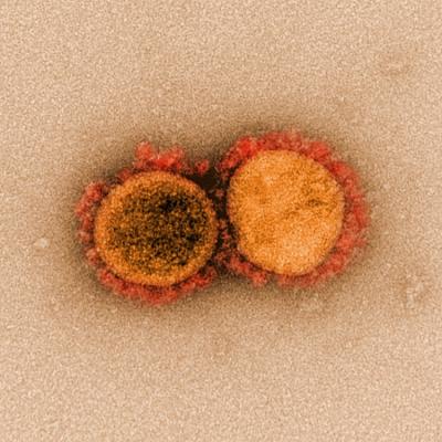 Electron micrograph of SARS-CoV-2 virus particles