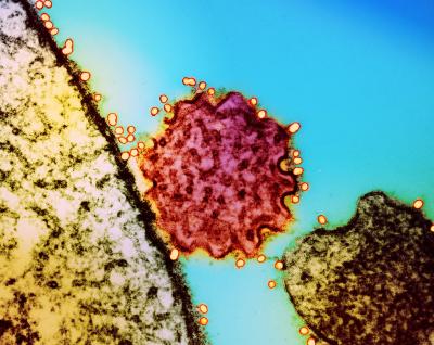 Colorized transmission electron micrograph of a single Nipah virus particle (center, colorized that has budded from the surface of an infected cell