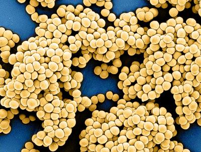 Colorized image of Methicillin-resistant Staphylococcus aureus (MRSA) bacteria; from a scanning electron micrograph captured at the NIAID Integrated Research Facility (IRF) in Fort Detrick, Maryland.