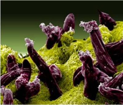 Scanning electron micrograph of Plasmodium gallinaceum invading mosquito midgut