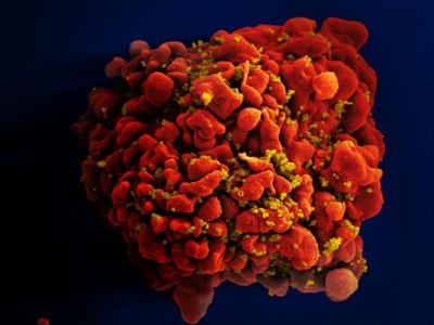 Scanning electron micrograph of an HIV-infected H9 T cell