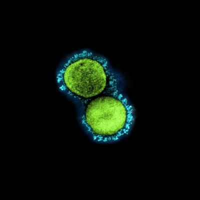 A transmission electron micrograph of circular SARS-CoV-2 virus particles, colored green and blue