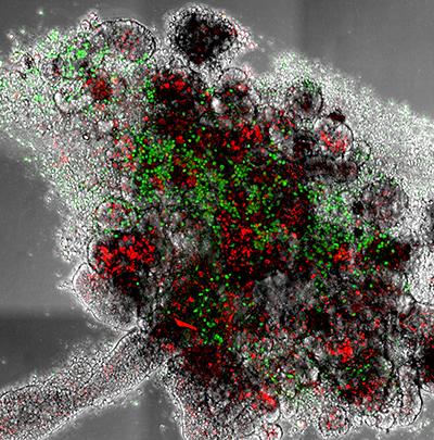 Red and green splotches within white bubble like shapes