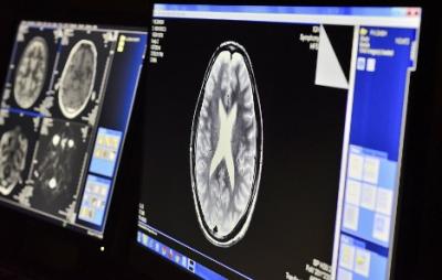 An MRI console used to study cerebral malaria in patients in India. 