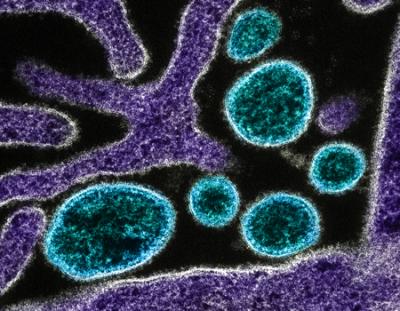 Nipah virus particles under microscope