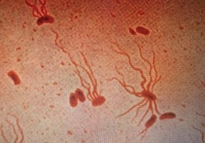 S. Typhi shown under a microscope